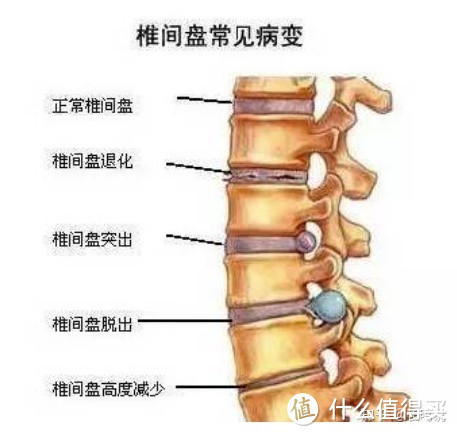 腰疼用护腰带有没有用？诺泰脉冲护腰带沉浸式测评！