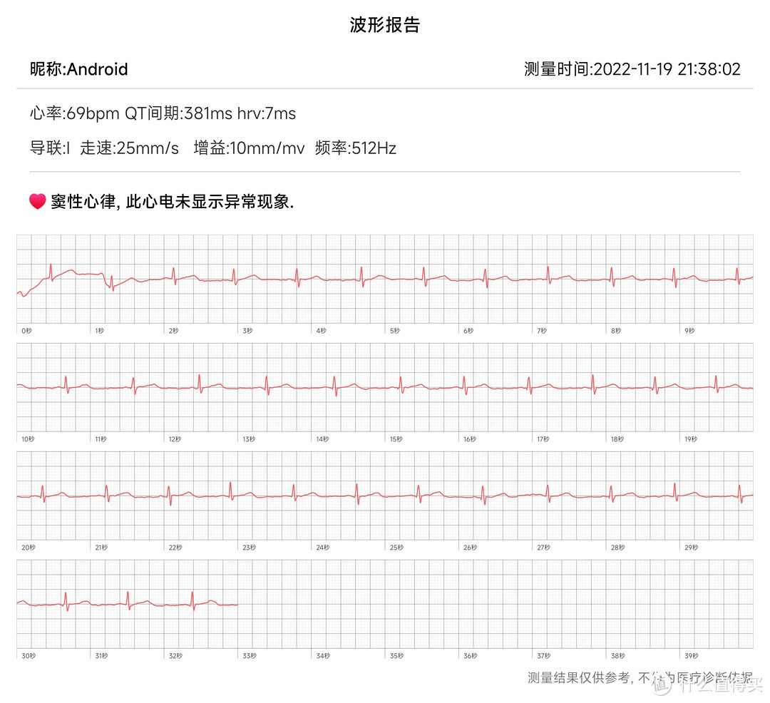 智能手表如何帮你全方位守护健康？Dido G28s Pro开箱