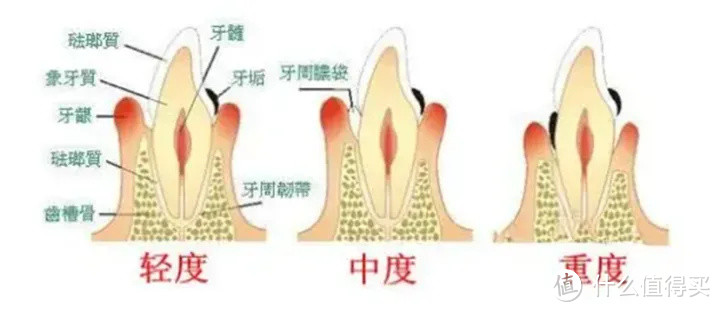 热门电动牙刷测评避雷，产品经理教你电动牙刷怎么选？