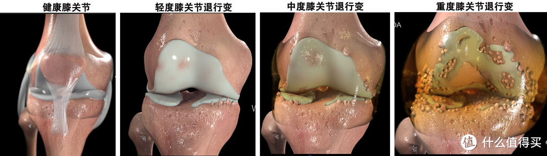 病情进展