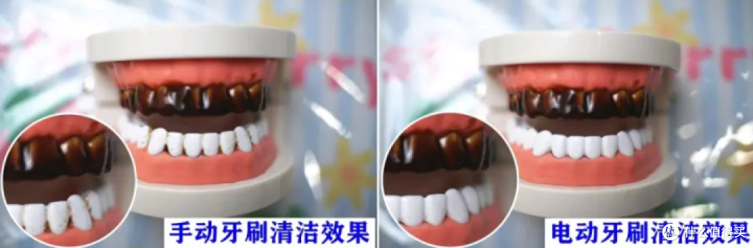 为什么要用电动牙刷?有什么性价比高的电动牙刷可以推荐?infly电动牙刷怎么样?