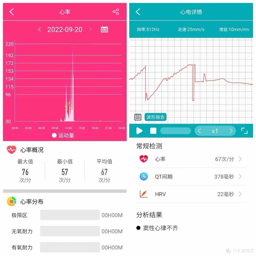 dido G28S Pro顶配版手表体验，高质量中年人的健康助手