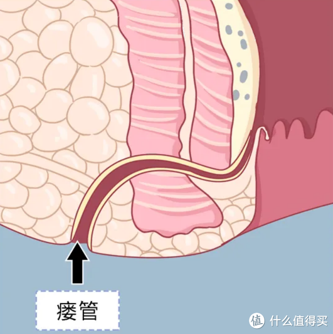 我的痔疮手术流水账（含肛瘘、肛周脓肿）