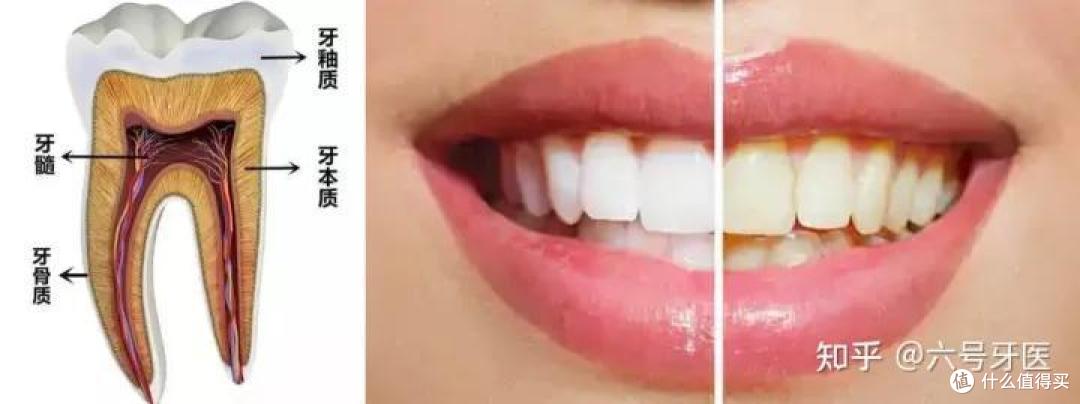 市面上琳琅满目的功能牙膏真的管用吗?