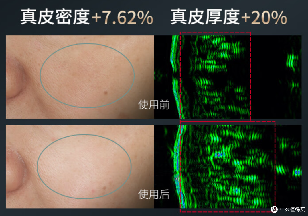 想要冬天更舒适,这些产品要配齐—分享四款让你身心舒畅的品质好物