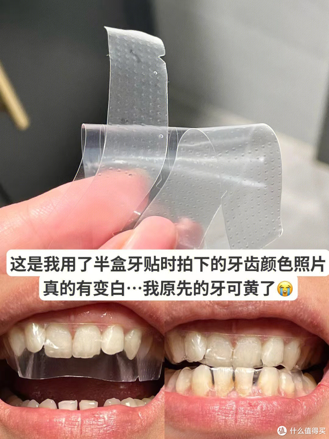 里面的成分可以分解牙垢 烟渍茶渍等 针对外源性黄牙 含护敏因子不会酸牙