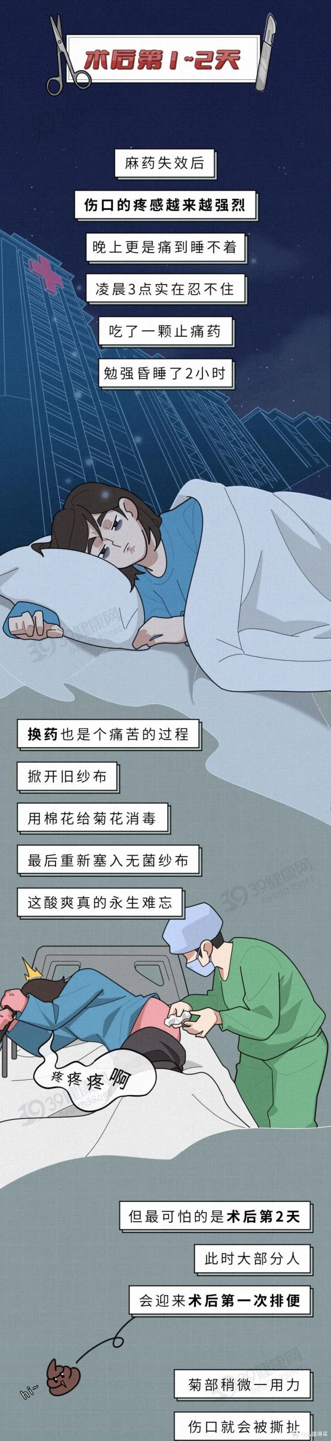 一个妙龄少女的“痔疮手术”全过程