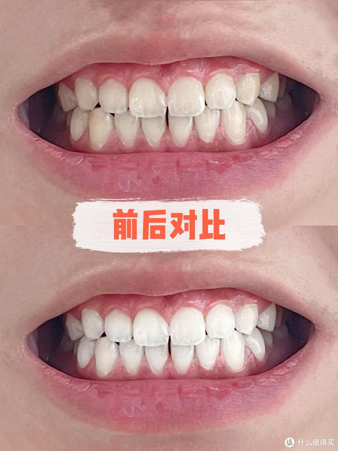 Coficoli可菲可丽洁白冲牙器测评：专利美白牙齿，让笑容更自信