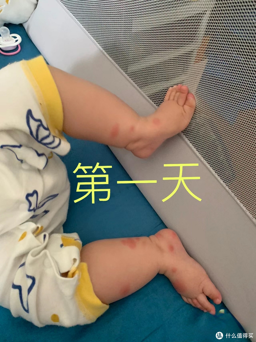 我家宝的腿 