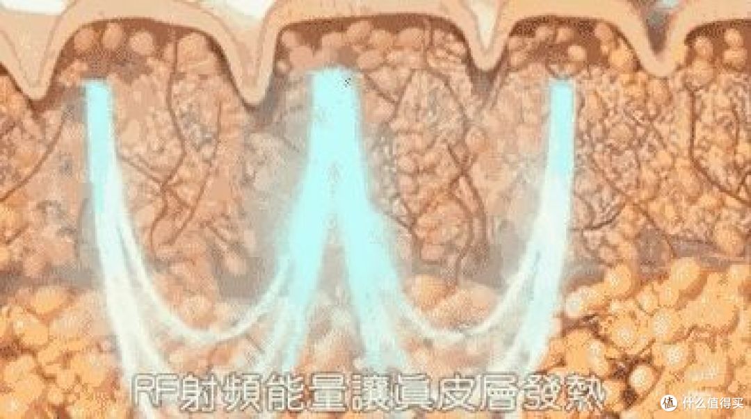 25岁后皮肤松弛严重，有必要花好几千买台美容仪吗？射频美容仪真的抗老有奇效吗？有什么好用的牌子推荐？