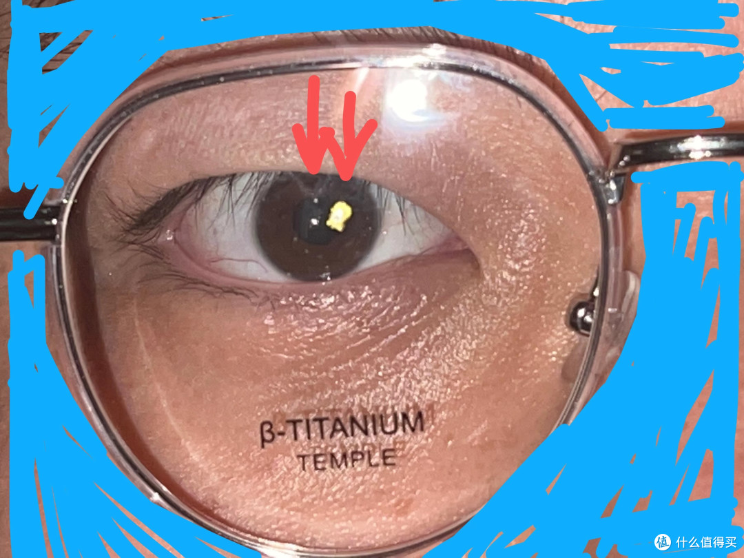 以右眼为例，图中黄色的点，是面对面点瞳高的位置，比实际位置偏了2、3mm