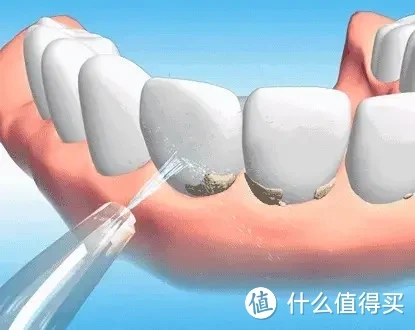 拒绝云测评,十大热门冲牙器测评:洁碧/扉乐/Usmile/松下/米家/舒客等品牌怎么选?高性价比冲牙器