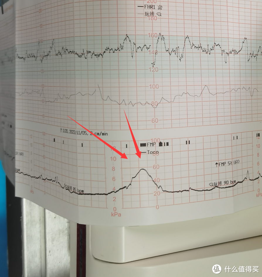 人类幼崽养成计划：从怀孕到出生的那些注意事项