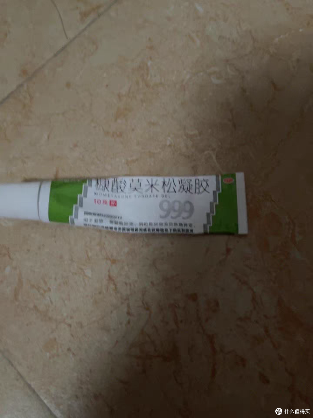 过敏的烦恼之手背湿疹