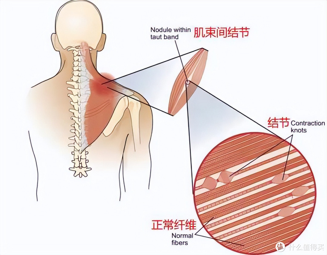 选筋膜枪总翻车？筋膜枪测评合集-热门筋膜枪真人实测对比：未野、Artsmith、Nurtria等，哪个牌子好?