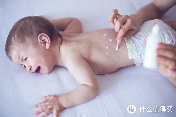 床垫不透气宝宝容易起红疹