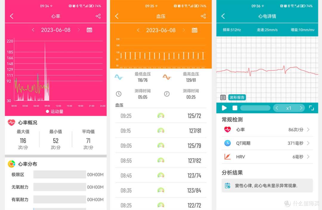 一个手表，看透你的健康：可以当holter用的智能手表来了！
