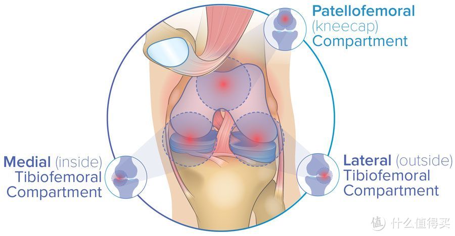 2023徒步指南（9）：髌骨带跟护膝有何区别