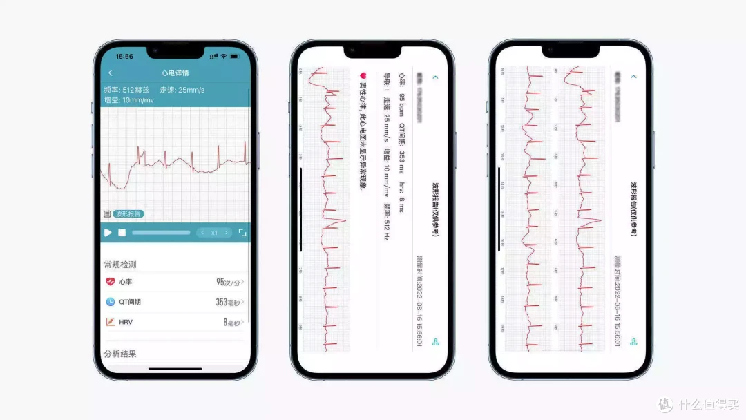dido G28s智能手表:ECG+PPG混动导联,24H守护健康