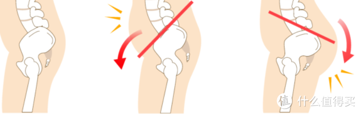 不同的骨盆位置