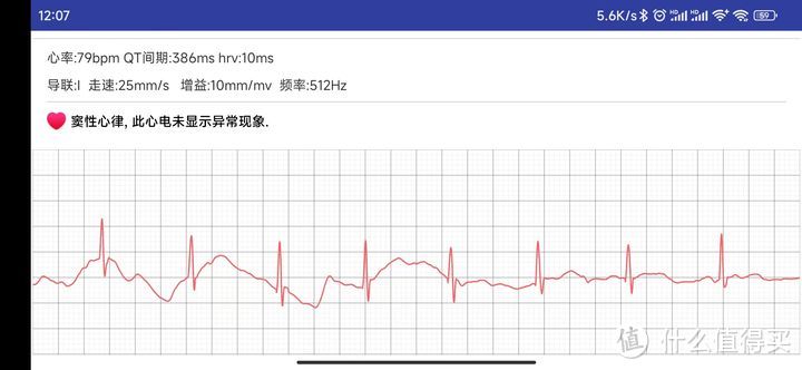 dido G28S心电血压智能手表开箱评测，功能丰富，注重健康监测