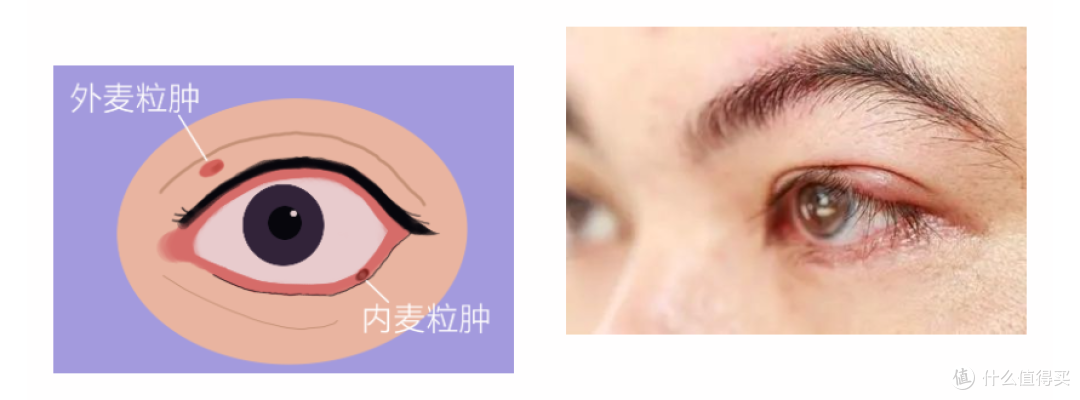 秘籍 | 眼部护理难?那你一定还没看过这篇!