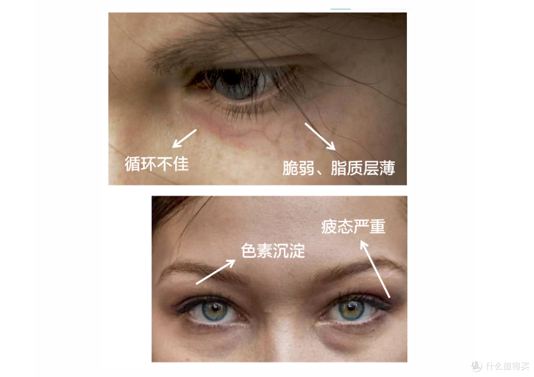 秘籍 | 眼部护理难?那你一定还没看过这篇!