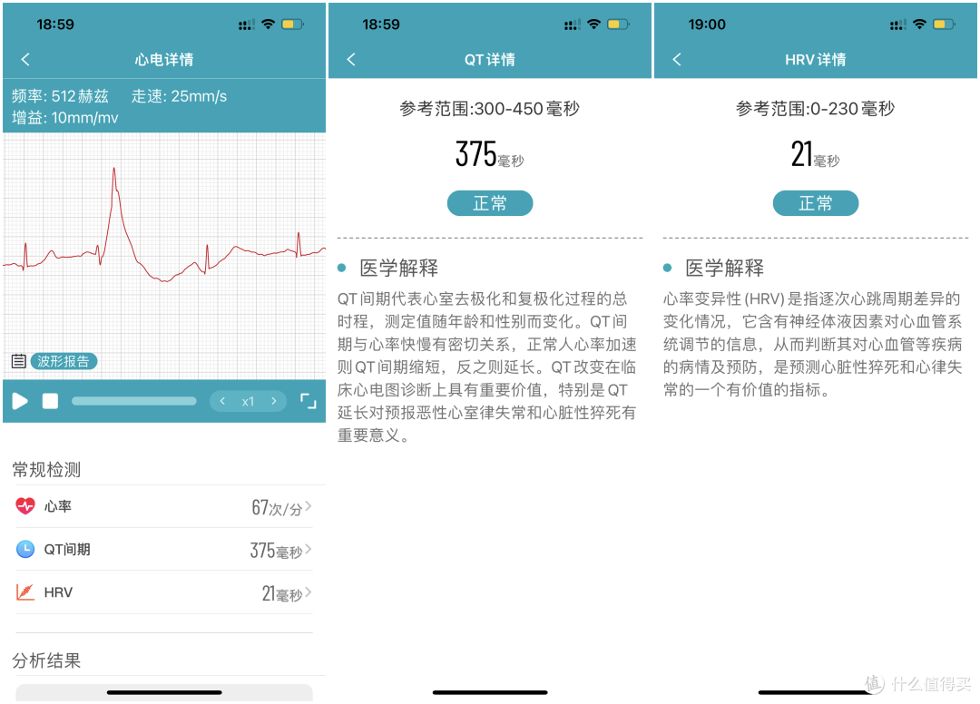 dido E55S智能手表评测:24小时健康监测,血压血糖异常早知道