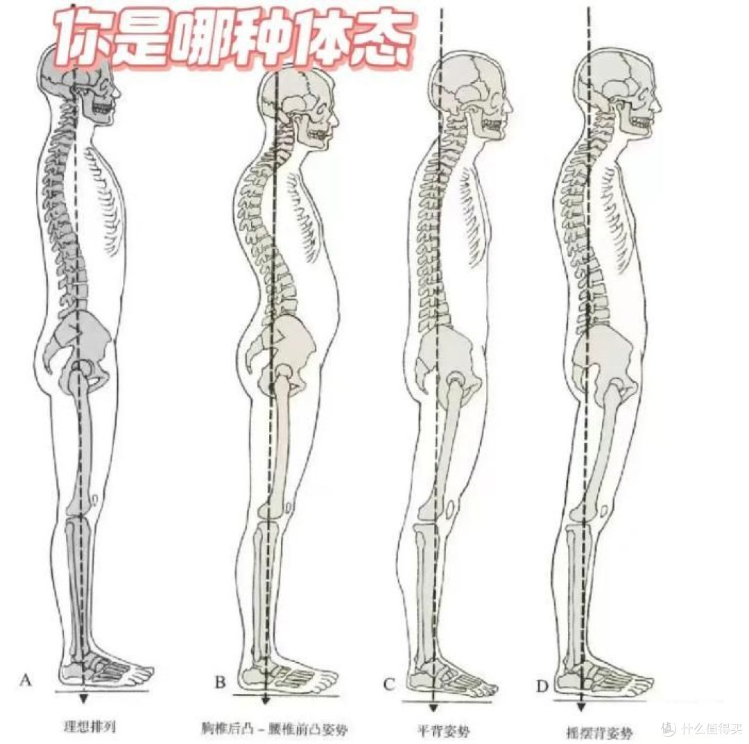 你的脊柱正常么？