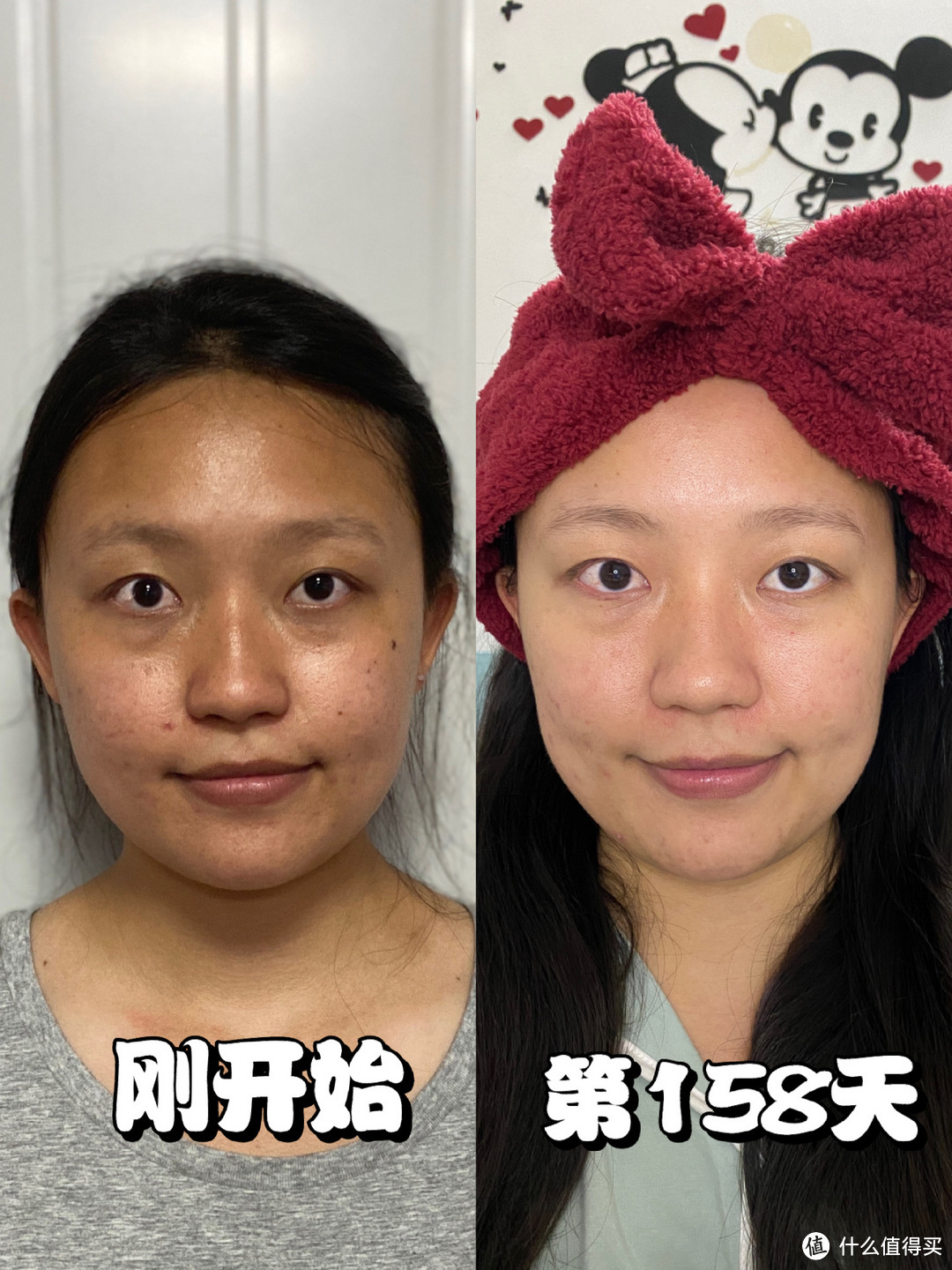 “长期化妆”和“长期素颜”的女生，哪一个皮肤更好？答案很明显