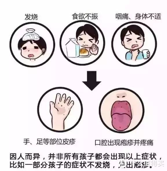 手足口病图片