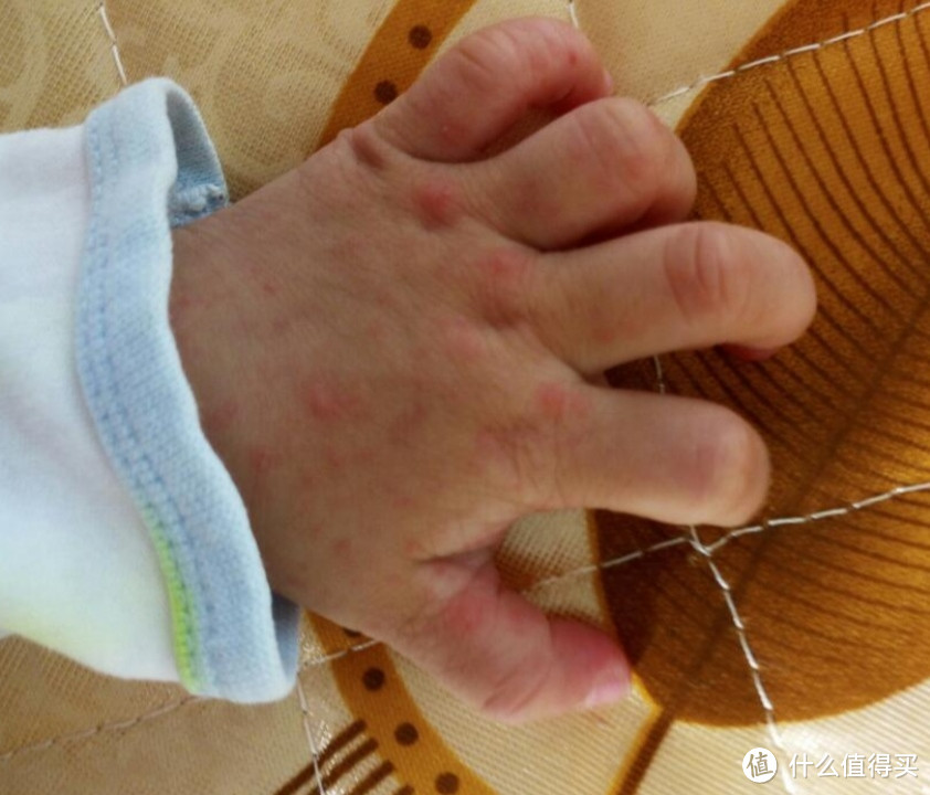 手足口病的防范,注意家里的孩子卫生。