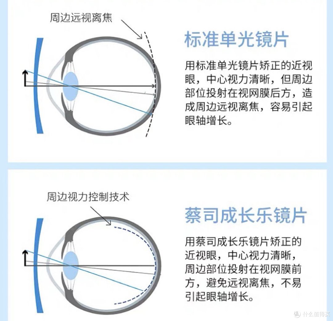 蔡司眼镜周边视力离焦技术,让你的眼睛更健康,更明亮!