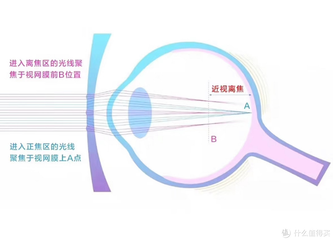 儿童近视防控眼镜,年龄越小越要注意