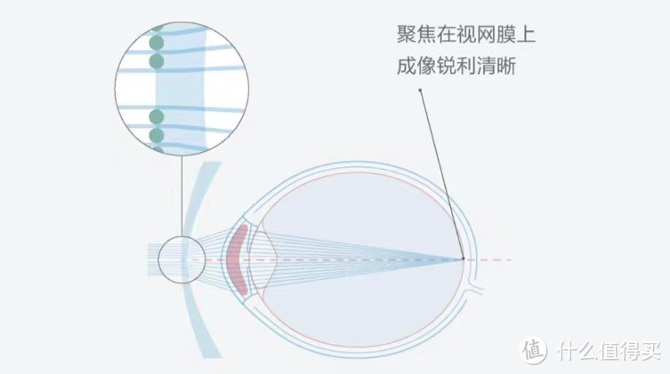 儿童近视防控眼镜，年龄越小越要注意