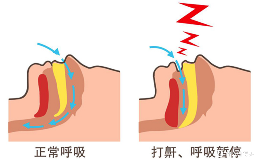 四千元价位的国产呼吸机，乐普R20跟瑞迈特A20，从体验来说谁更好？