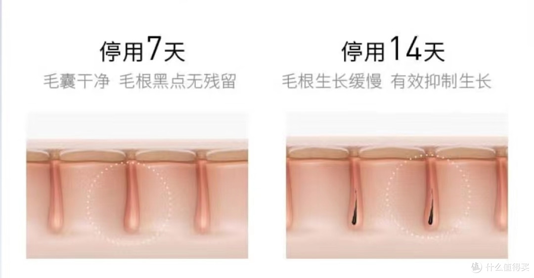 Ulike 脱毛仪:让你轻松摆脱毛发困扰,拥有光滑肌肤!