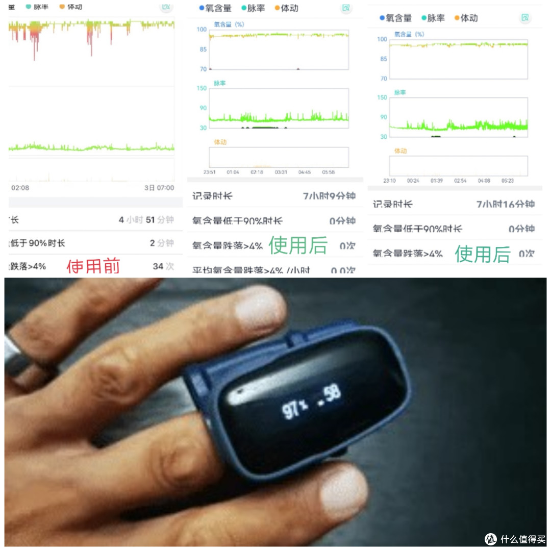 呼吸机怎么选？国产呼吸机巅峰对决之乐普、瑞迈特