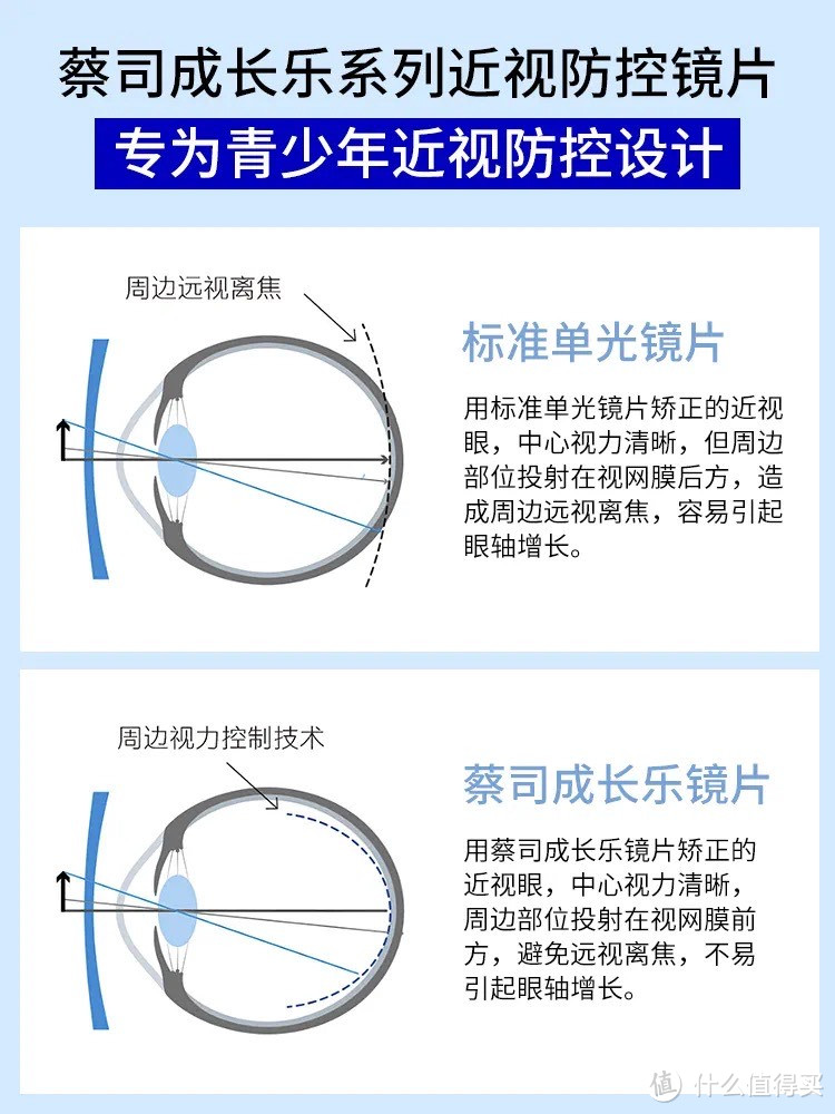 儿童防控眼睛的核心“镜片”材质如何选择呢，一起来学习一下吧