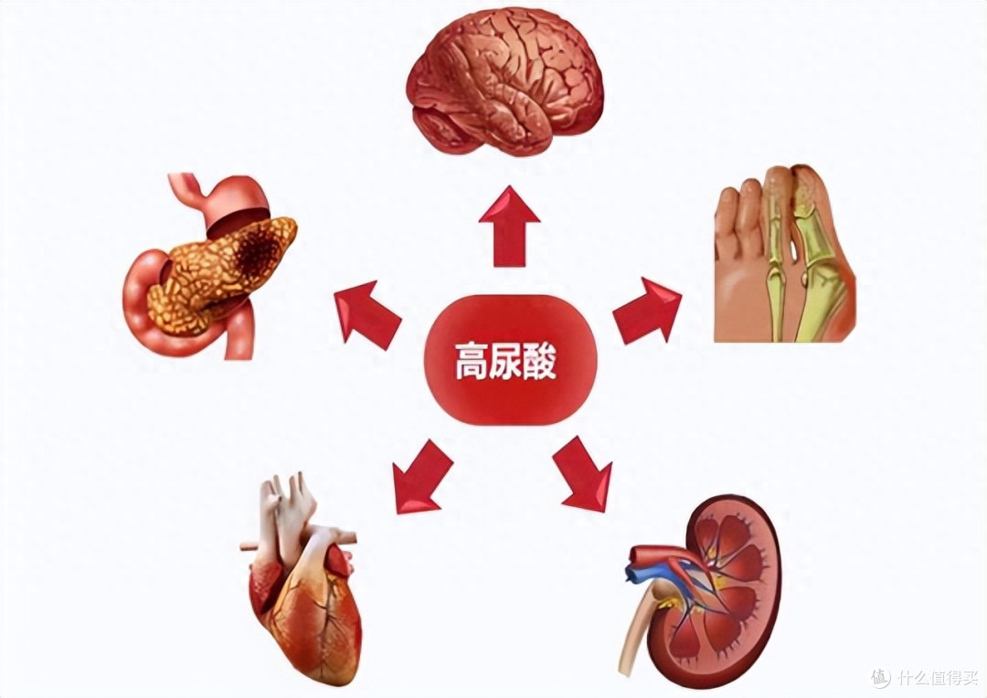 尿酸高是怎么一回事?什么原因引起的高尿酸?