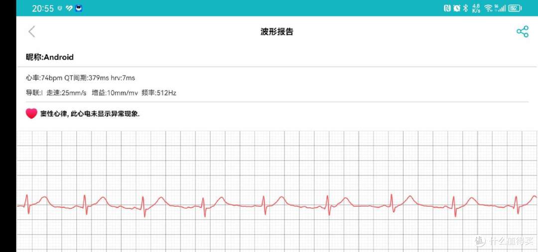 dido E56S智能手表评测:全方位健康管家,国货智能穿戴新标杆!