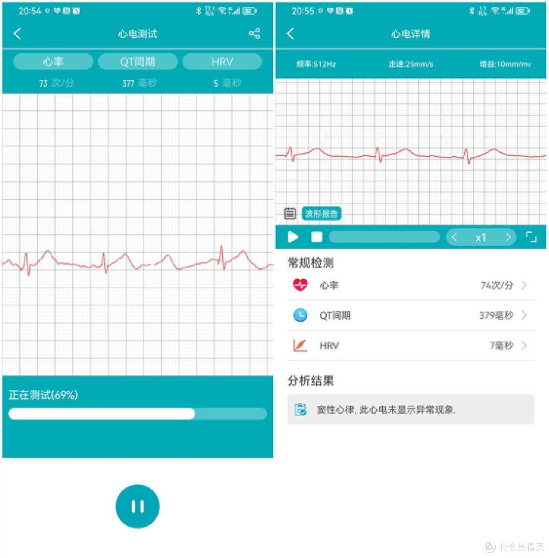 dido E56S智能手表评测:全方位健康管家,国货智能穿戴新标杆!