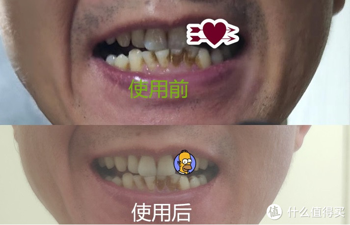 大牌性价比好物,我的牙结石被刷没了。