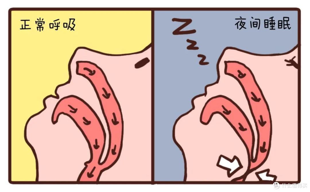 告别睡眠质量差,拒绝打鼾大烦扰——呼吸机选购攻略与实例解析