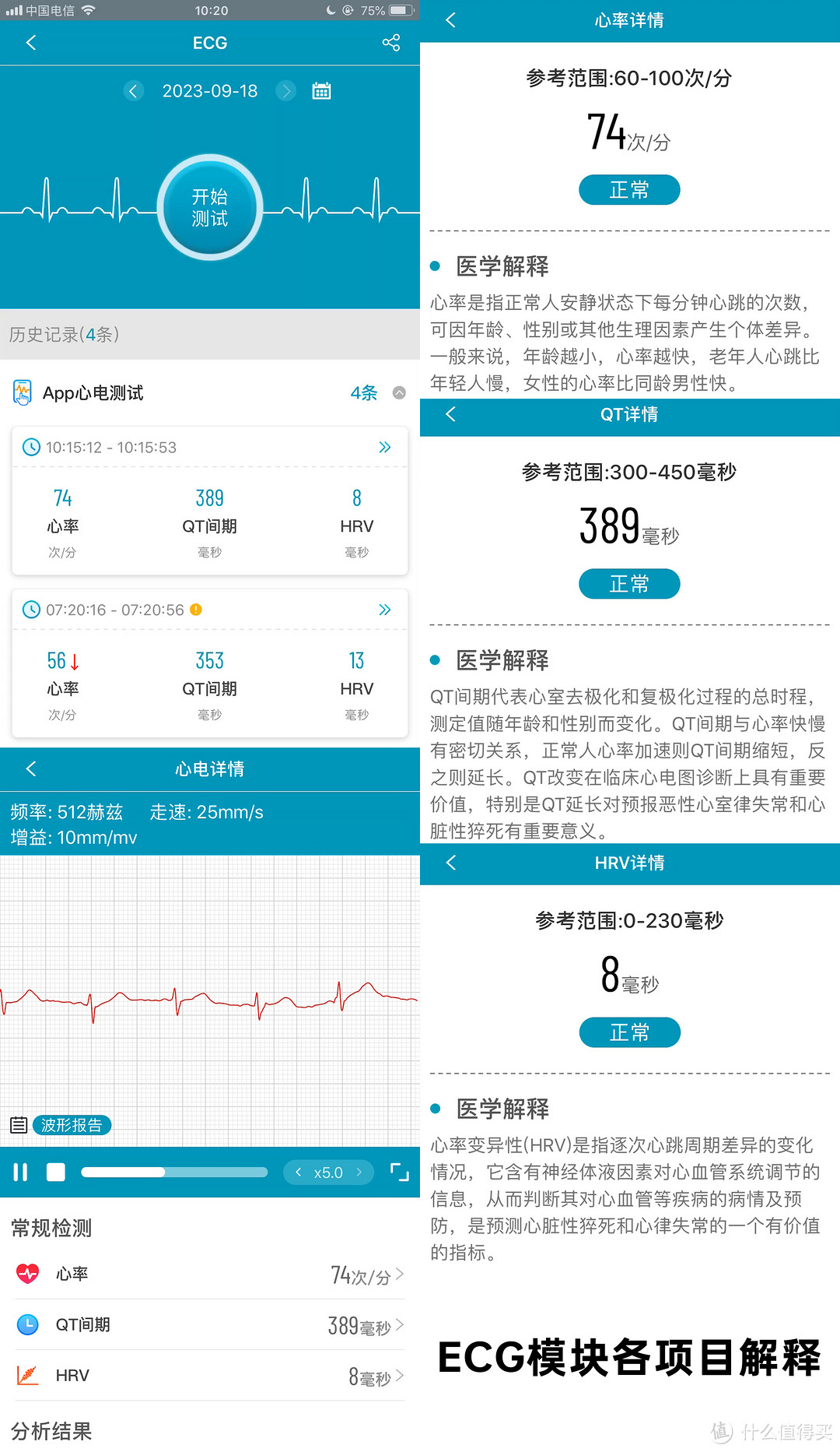 别人有的我有，别人没有的我也有-dido E56S健康智能手表评测体验