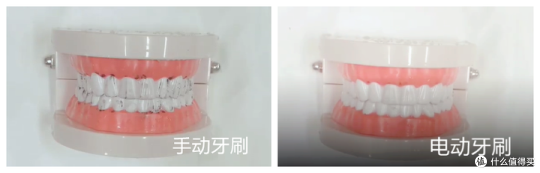 儿童牙刷是电动的好还是手动的好？警惕五类智商税隐患