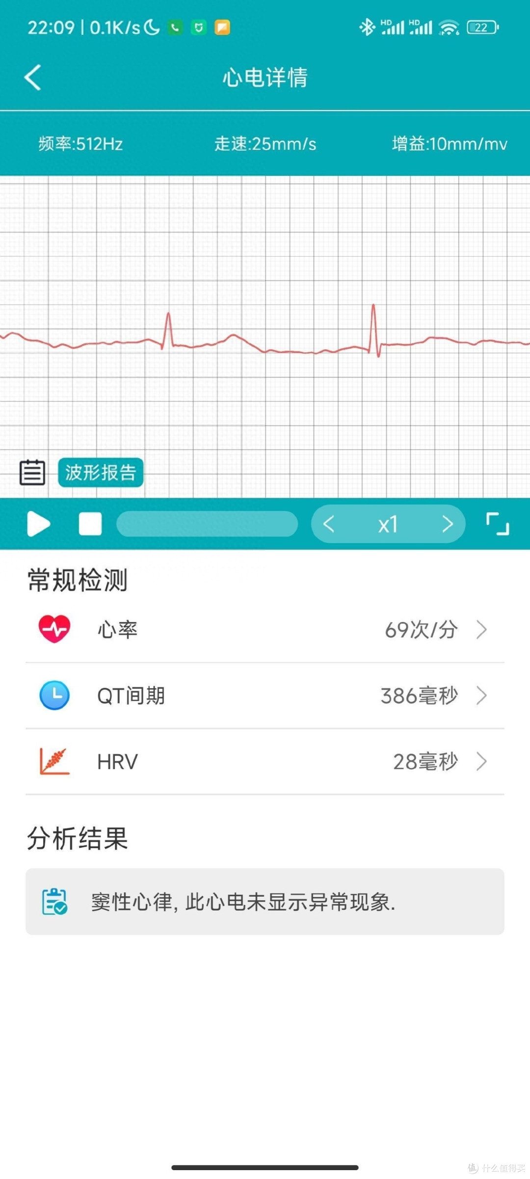 didoE55SPRO智能手表无感健康分析，保护你的健康