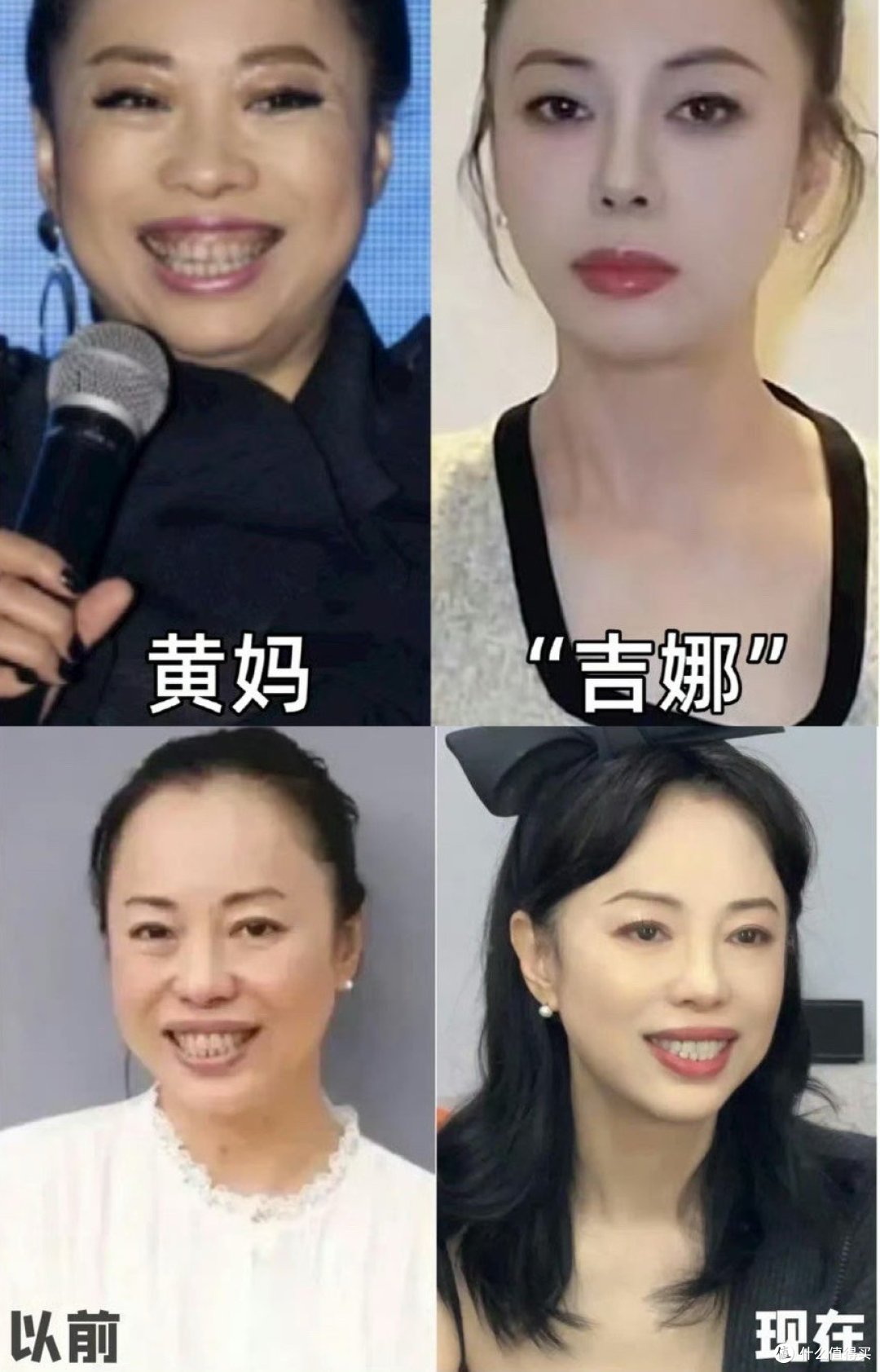 被怀疑打了玻尿酸？其实只是用了它！