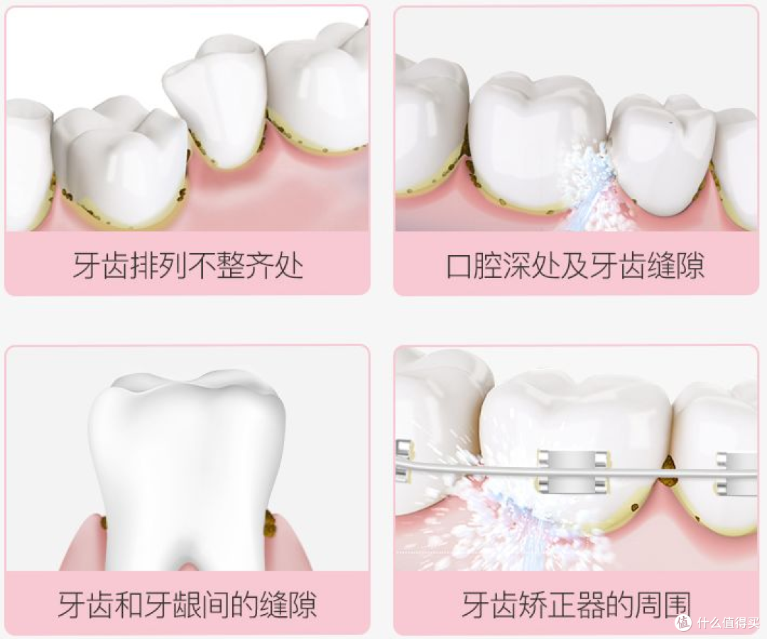 正畸矫正牙齿必须用冲牙器吗？谨防三大危害风险！
