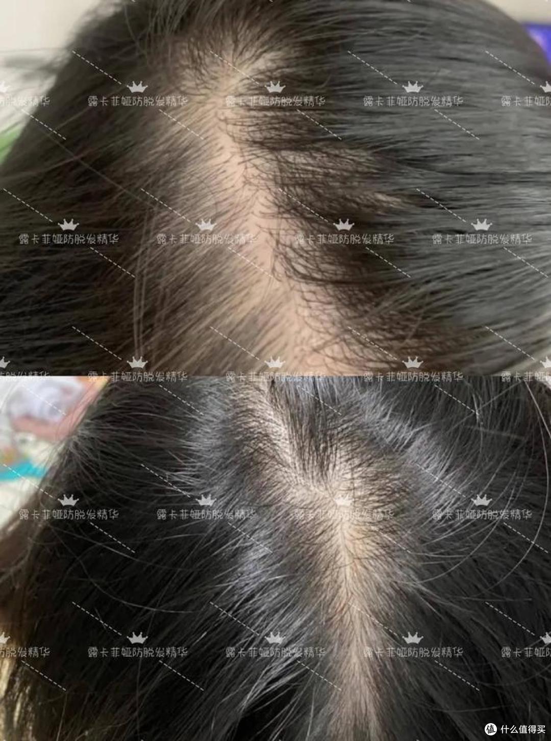 世界十大防脱生发液排行榜，满头秀发不是梦